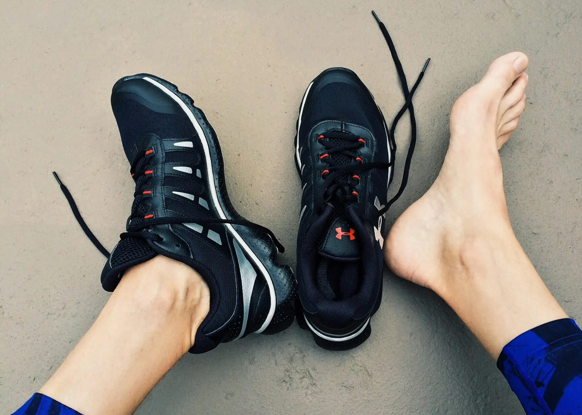 Plantar fasciitis